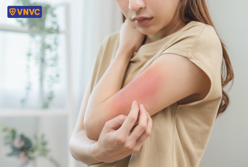 ngứa da do viêm gan b