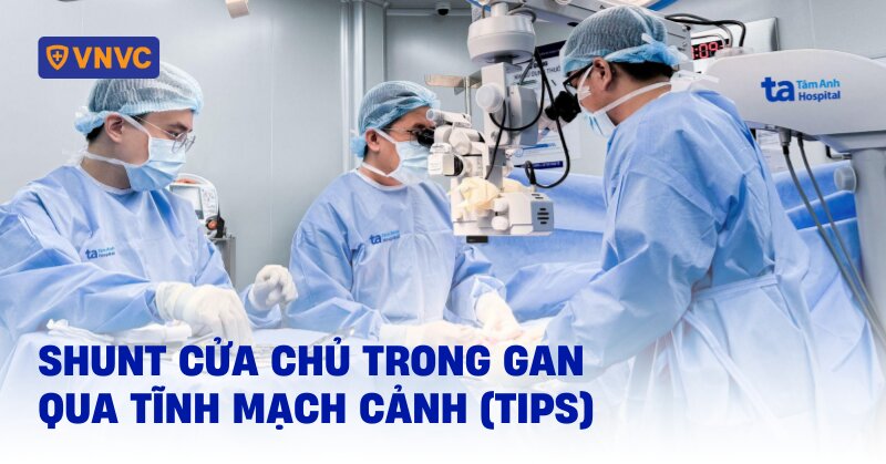 shunt cửa chủ trong gan qua tĩnh mạch cảnh