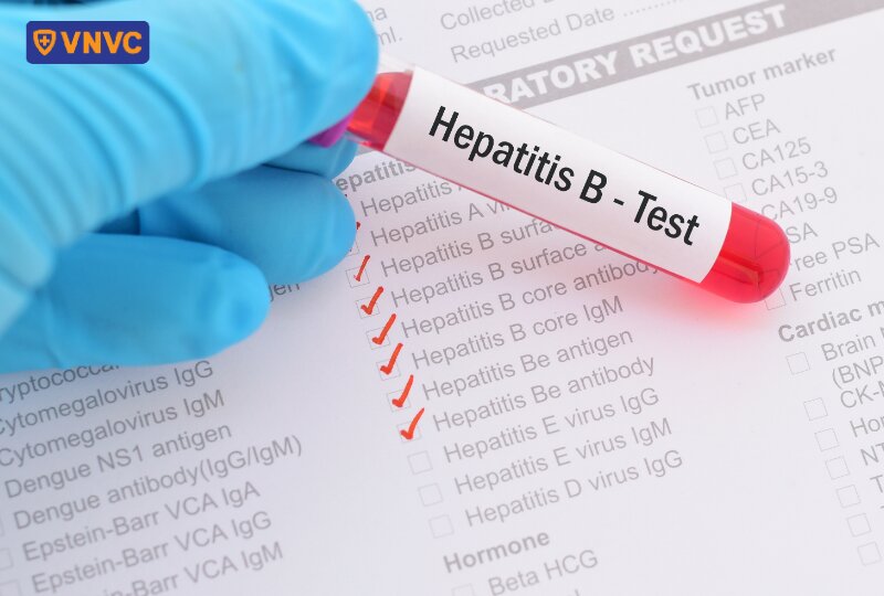 thực hiện xét nghiệm hbv