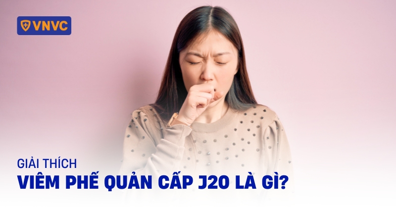 viêm phế quản cấp j20