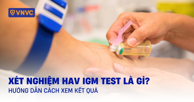 Xét nghiệm HAV IgM test là gì? Hướng dẫn cách xem kết quả