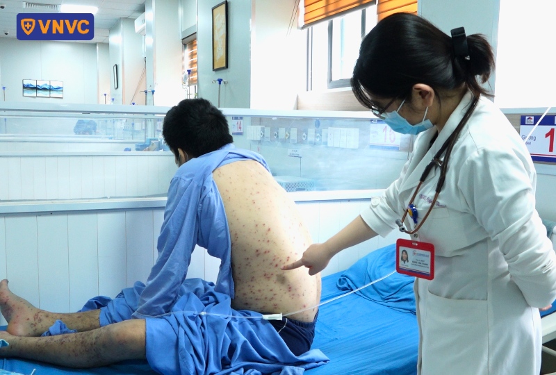 bác sĩ khám bệnh nhân thủy đậu