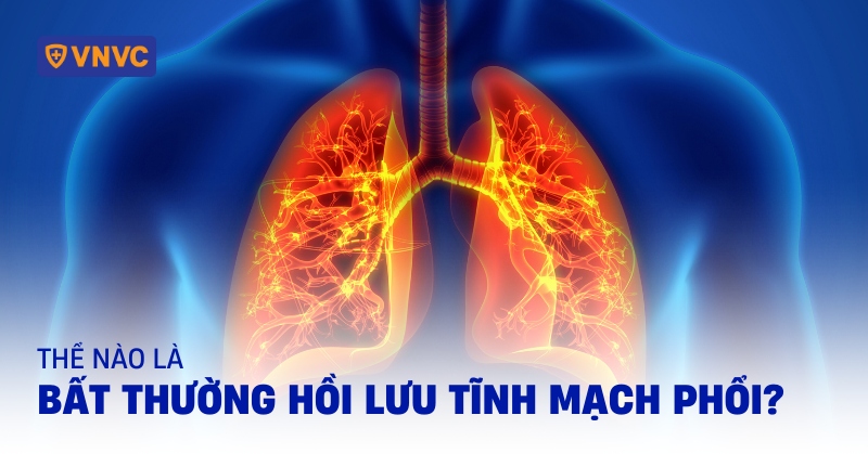 bất thường hồi lưu tĩnh mạch phổi