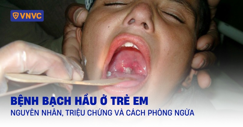bệnh bạch hầu ở trẻ em