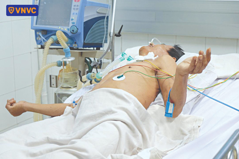 bệnh nhân uốn ván nặng điều trị hồi sức