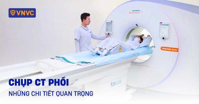chụp ct phổi