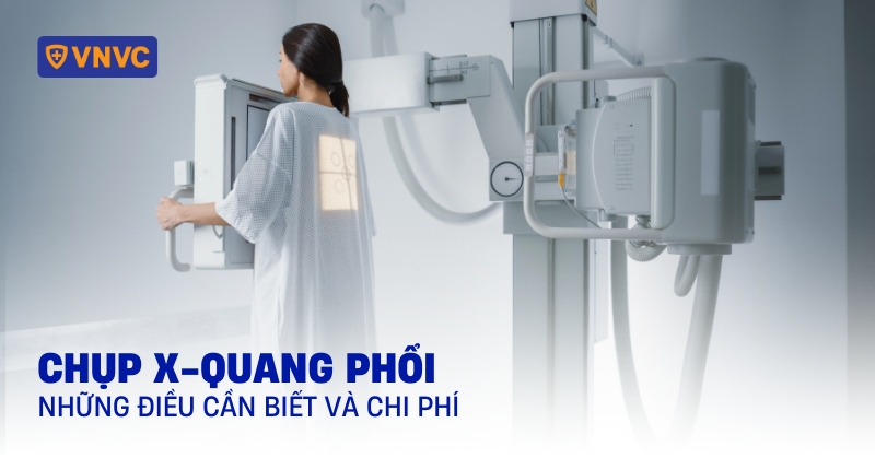 chụp x quang phổi
