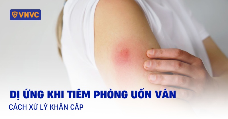 dị ứng khi tiêm phòng uốn ván
