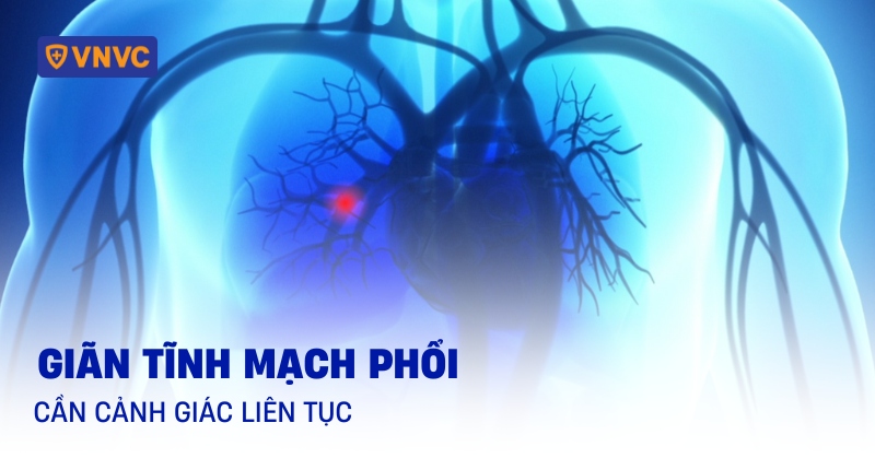 giãn tĩnh mạch phổi