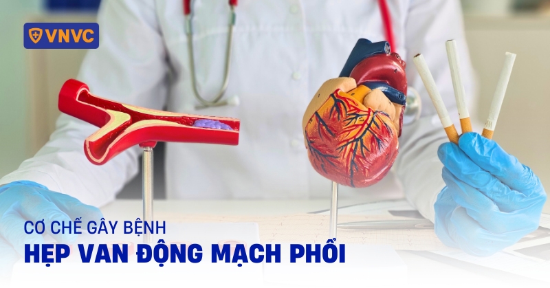 hẹp van động mạch phổi