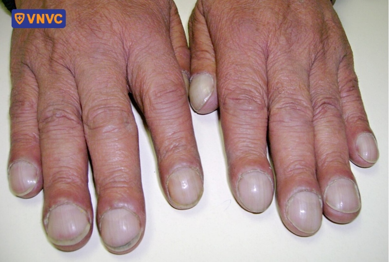 ngón tay dùi trống