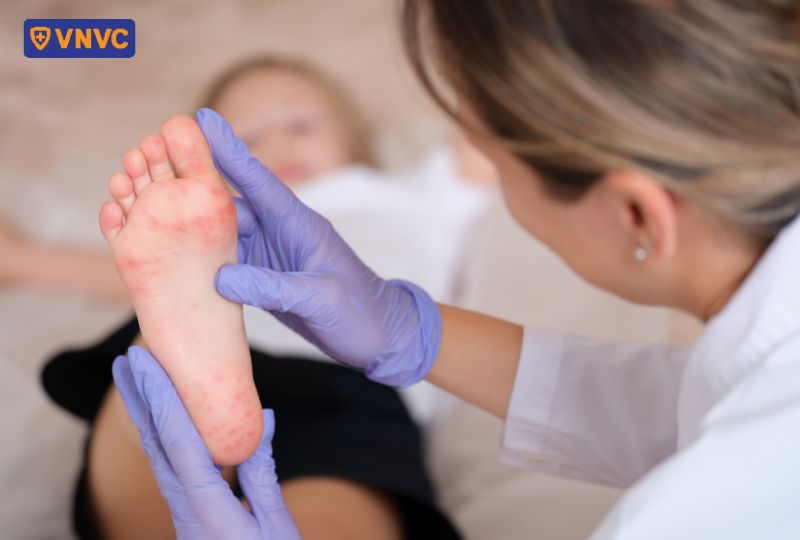 nốt ban đỏ mọc ở chân