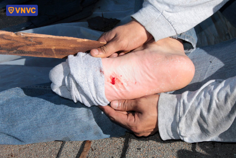 vết thương ở bàn chân do giẫm vật nhọn