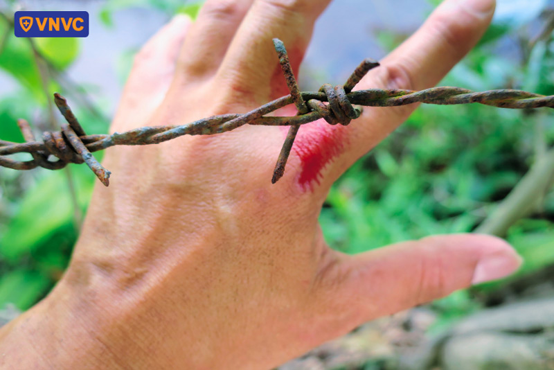 vi khuẩn uốn ván có thể xâm nhập qua vết thương hở