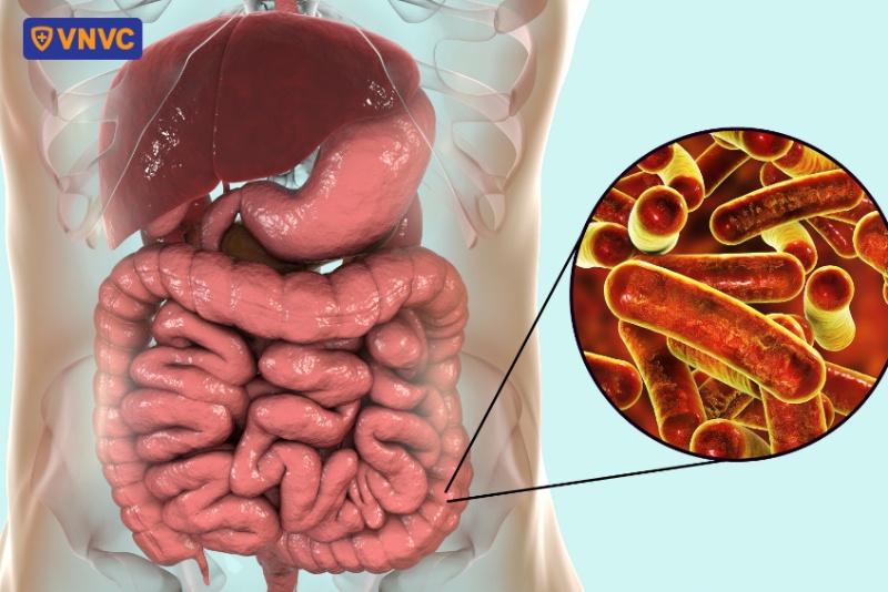 vi khuẩn Shigella gây bệnh kiết lỵ ở người