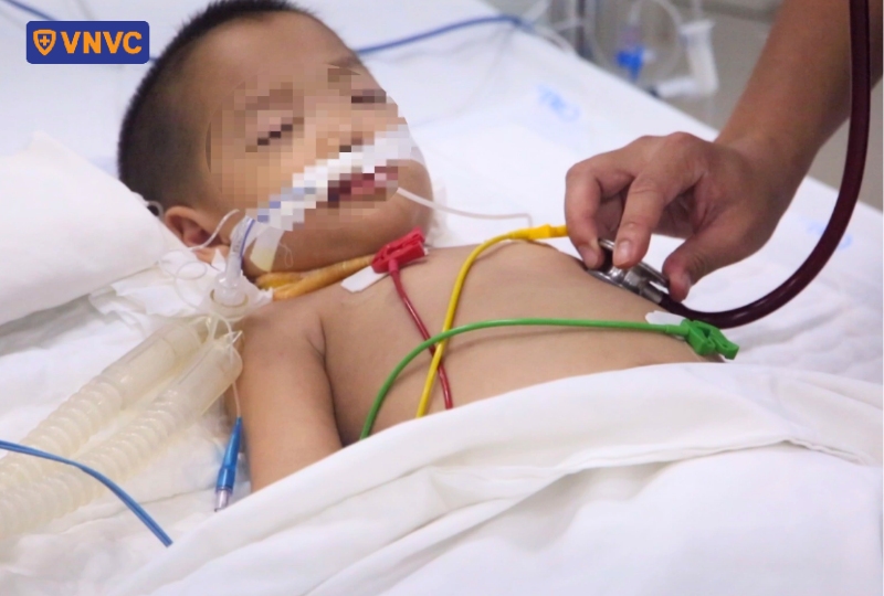 bác sĩ khám cho bé có biến chứng nặng