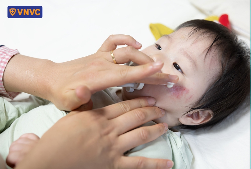 sát khuẩn cho bé