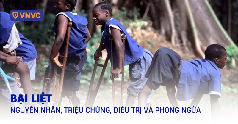 bệnh bại liệt là gì