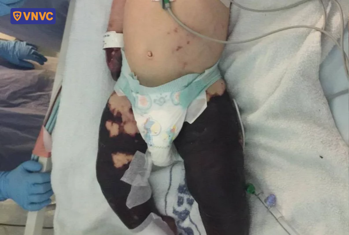 bệnh nhân nổi tử ban