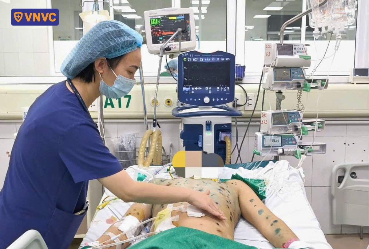 điều trị thủy đậu trong bệnh viện