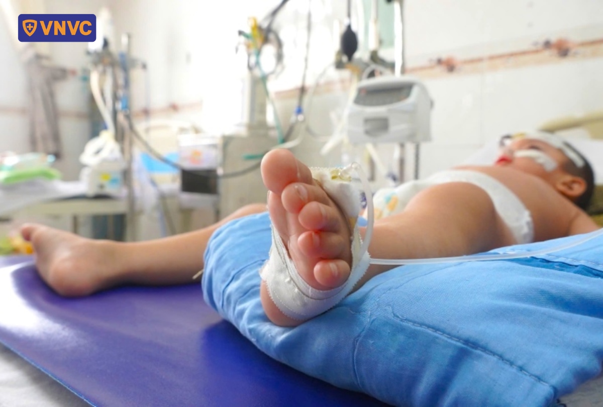 bệnh nhi biến chứng do sởi