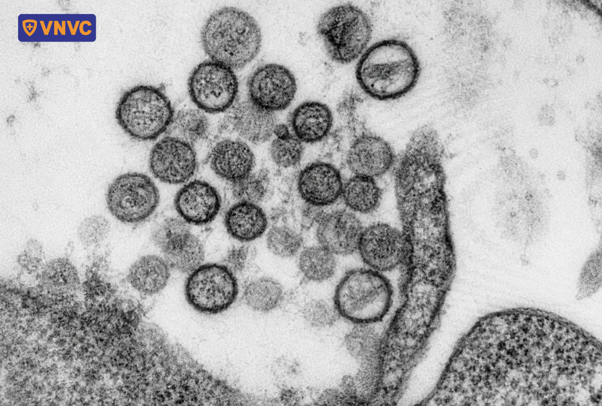 hạt virus andes