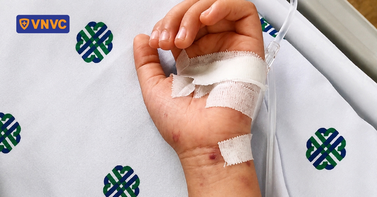 Bé trai tử vong do viêm màng não mủ biến chứng tại Đắk Lắk