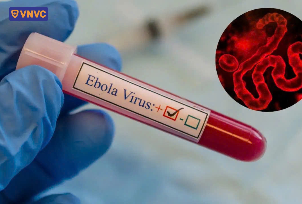 xét nghiệm virus rừng tai
