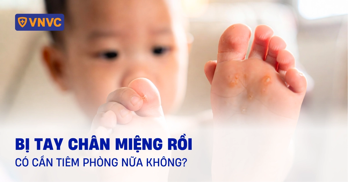 bị tay chân miệng rồi có cần tiêm phòng nữa không