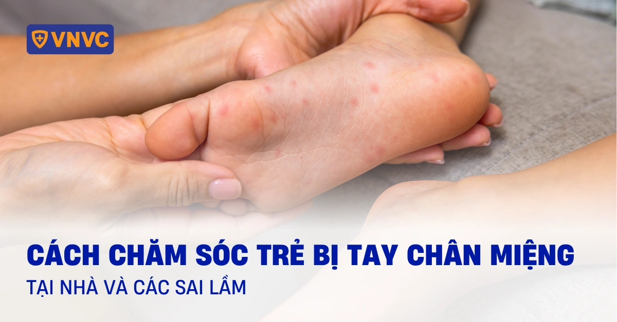 chăm sóc trẻ bị tay chân miệng tại nhà