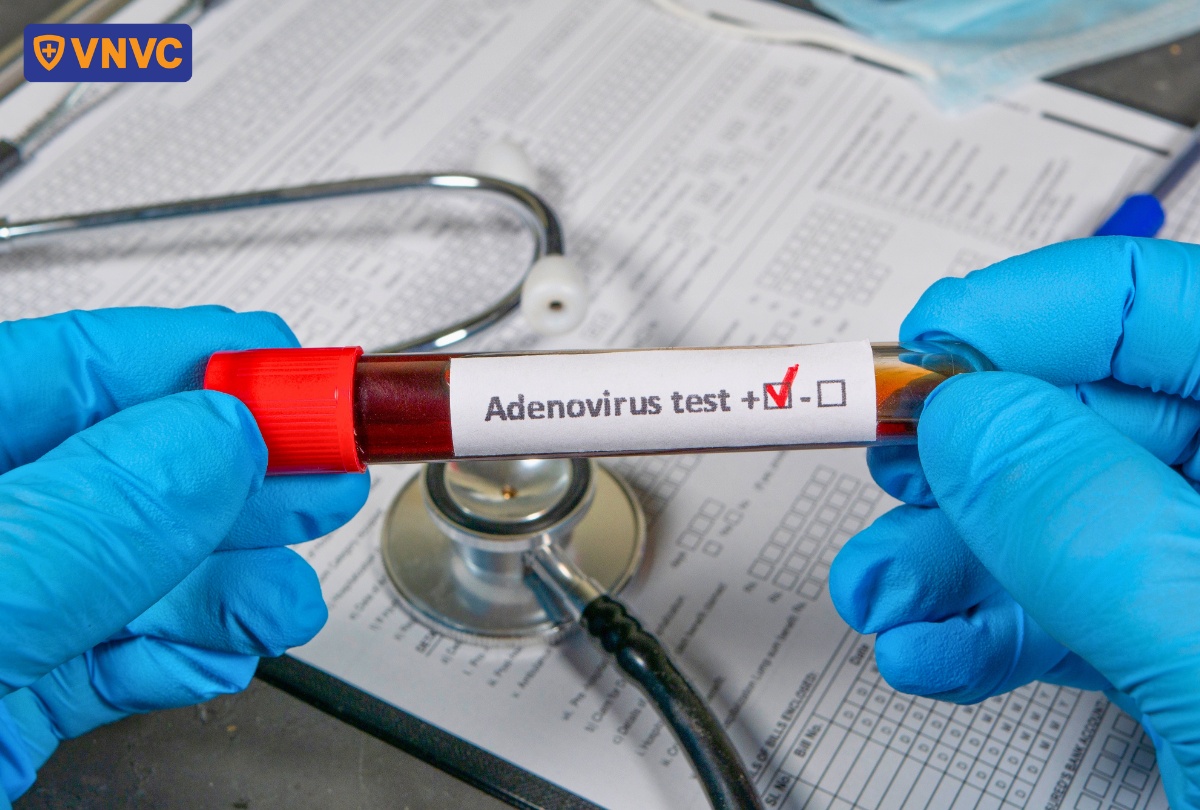 ống xét nghiệm adenovirus
